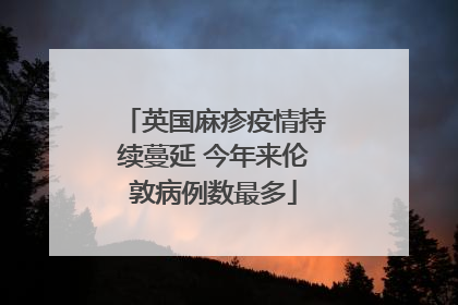 英国麻疹疫情持续蔓延 今年来伦敦病例数最多
